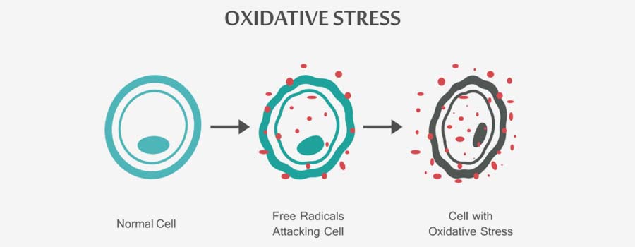 Oxidative Stress